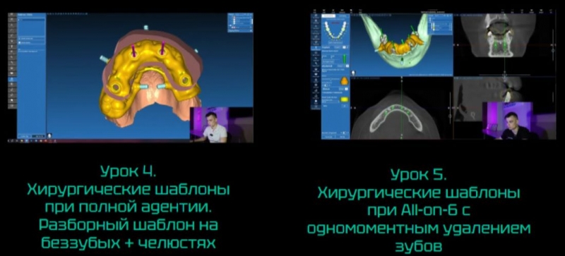 Учебный курс по хирургическим шаблонам в системе RealGuide